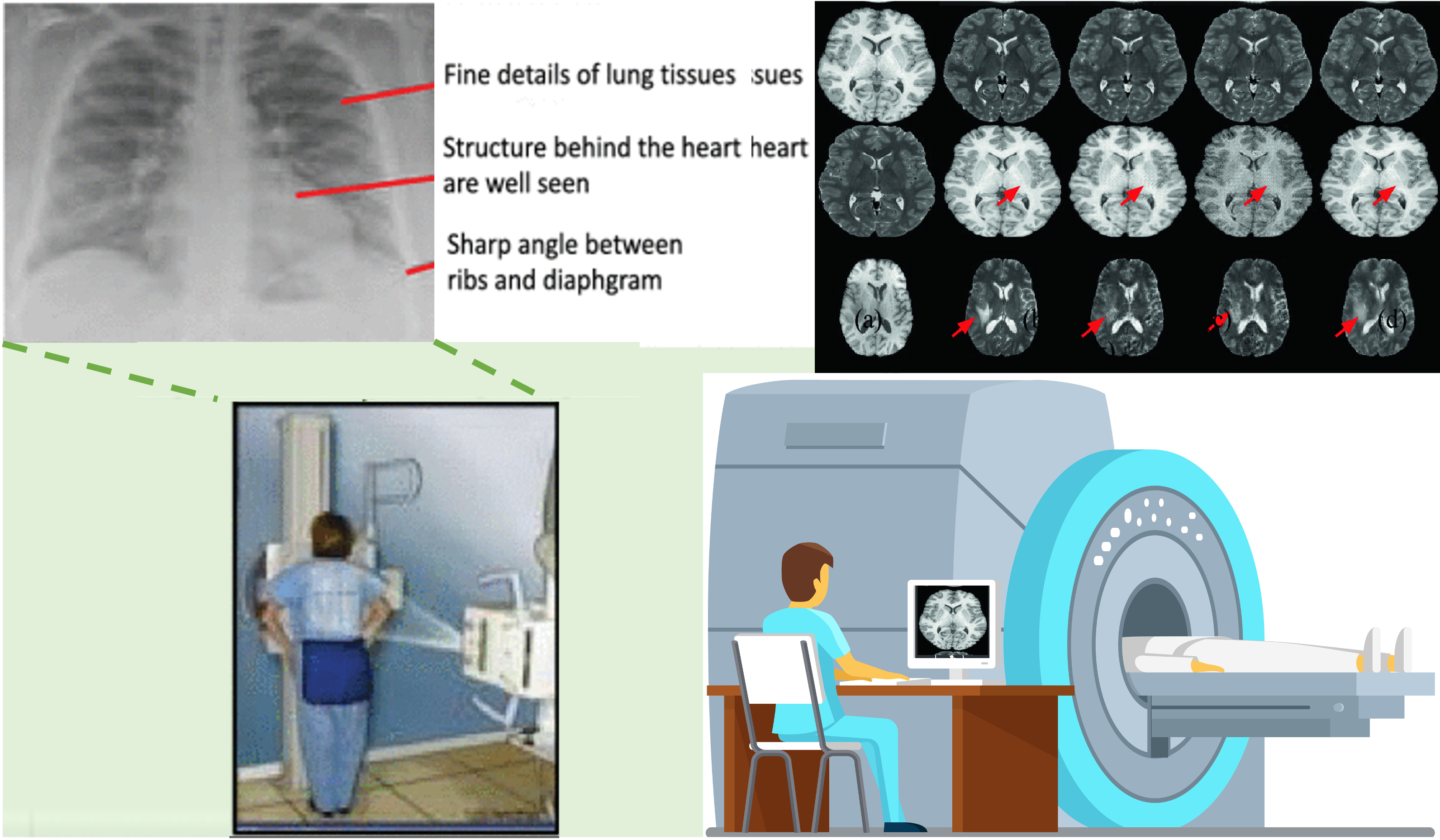 Smart Health and Medical Imaging